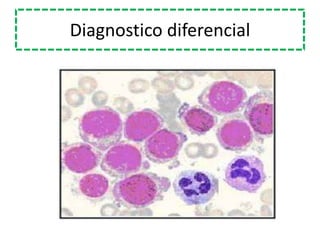 Diagnostico diferencial
 