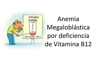 Anemia
Megaloblástica
por deficiencia
de Vitamina B12
 