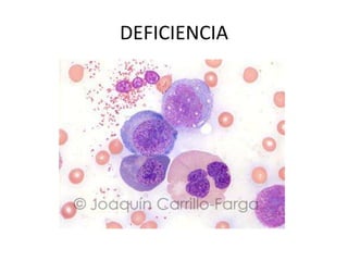 DEFICIENCIA
 