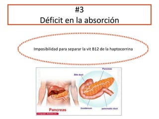 #3
Déficit en la absorción
Imposibilidad para separar la vit B12 de la haptocorrina
 