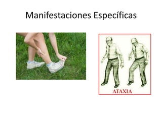 Manifestaciones Específicas
 