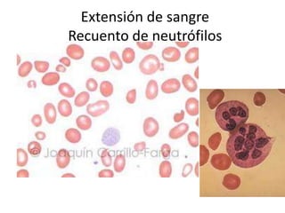 Extensión de sangre
Recuento de neutrófilos
 