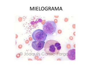 MIELOGRAMA
 