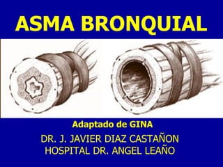 ASMA BRONQUIAL Adaptado de GINA DR. J. JAVIER DIAZ CASTAÑON HOSPITAL DR. ANGEL LEAÑO 
