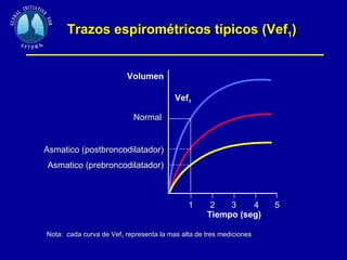 Trazos espirométricos típicos (Vef 1 )   1 Tiempo (seg) 2 3 4 5 Vef 1 Volumen Normal  Asmatico (postbroncodilatador) Asmatico (prebroncodilatador) Nota:  cada curva de Vef 1  representa la mas alta de tres mediciones  