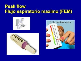 Peak flow  Flujo espiratorio maximo (FEM) 