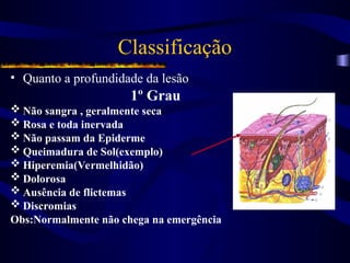 Classificação
• Quanto a profundidade da lesão
1º Grau
 Não sangra , geralmente seca
 Rosa e toda inervada
 Não passam da Epiderme
 Queimadura de Sol(exemplo)
 Hiperemia(Vermelhidão)
 Dolorosa
 Ausência de flictemas
 Discromias
Obs:Normalmente não chega na emergência
 