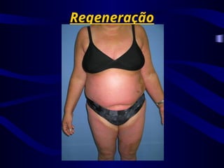 Regeneração
 