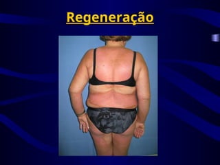 Regeneração
 