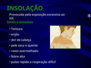 INSOLAÇÃO
Provocada pela exposição excessiva ao
sol.
Sinais e sintomas
• Tontura
• enjôo
• dor de cabeça
• pele seca e quente
• rosto avermelhado
• febre alta
• pulso rápido e respiração difícil
 