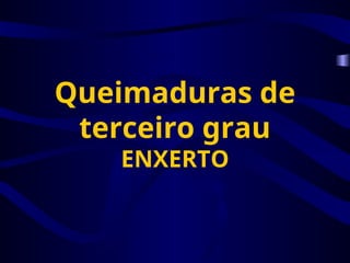Queimaduras de
terceiro grau
ENXERTO
 