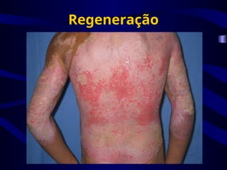 Regeneração
 