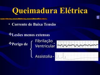 Queimadura Elétrica
• Corrente de Baixa Tensão
Lesões menos extensas
Perigo de
Fibrilação
Fibrilação
Ventricular
Ventricular
Assistolia
Assistolia
 