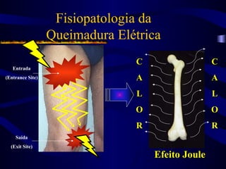 Fisiopatologia da
Queimadura Elétrica
Entrada
(Entrance Site)
Saída
(Exit Site)
C
C
A
A
L
L
O
O
R
R
C
C
A
A
L
L
O
O
R
R
Efeito Joule
Efeito Joule
 