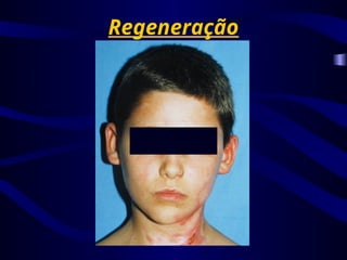 Regeneração
 