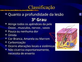  Quanto a profundidade da lesão
Quanto a profundidade da lesão
3º Grau
3º Grau
 Atinge todos os apêndices da pele
Atinge todos os apêndices da pele
Ossos , musculos, nervos , vasos
Ossos , musculos, nervos , vasos
 Pouca ou nenhuma dor
Pouca ou nenhuma dor
 Úmida
Úmida
 Cor Branca, Amarela ou Marrom
Cor Branca, Amarela ou Marrom
 Carbonização
Carbonização
 Ocorre alterações locais e sistêmicas
Ocorre alterações locais e sistêmicas
 Não cicatriza espontaneamente,
Não cicatriza espontaneamente,
necessita de enxerto
necessita de enxerto
Classificação
 