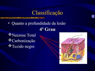 Classificação
• Quanto a profundidade da lesão
4º Grau
Necrose Total
Carbonização
Tecido negro
 