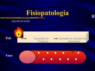 Fisiopatologia
Agressão do tecido
Vaso
Pele Exposição do
Exposição do
Colágeno
Colágeno
Liberação de Substâncias
Liberação de Substâncias
Vasoativas
Vasoativas
 