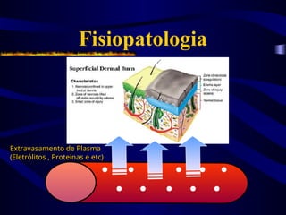 Fisiopatologia
Extravasamento de Plasma
Extravasamento de Plasma
(Eletrólitos , Proteínas e etc)
(Eletrólitos , Proteínas e etc)
 