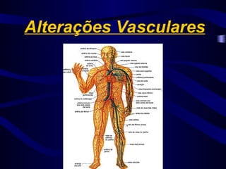 Alterações Vasculares
 