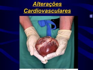 Alterações
Cardiovasculares
 