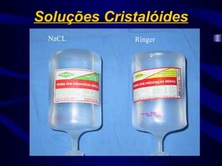 Soluções Cristalóides
NaCL Ringer
 