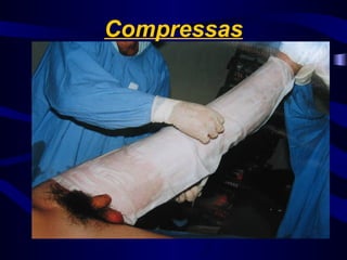 Compressas
 