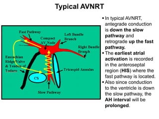 9.avnrt chang sl-0324-2 | PDF