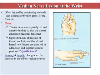 9-Axillary & Median Nerves[Replica].ppt nursing | PPT