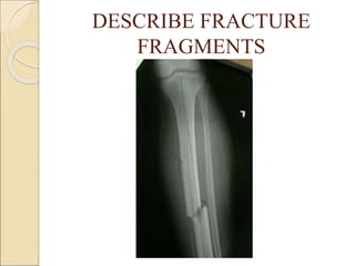 9- BASICS OF ORTHOPEDIC RADIOLOGY.ppt