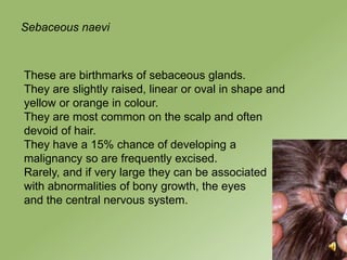 Sebaceous naevi



These are birthmarks of sebaceous glands.
They are slightly raised, linear or oval in shape and
yellow or orange in colour.
They are most common on the scalp and often
devoid of hair.
They have a 15% chance of developing a
malignancy so are frequently excised.
Rarely, and if very large they can be associated
with abnormalities of bony growth, the eyes
and the central nervous system.
 