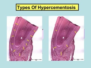 9 cementum | PPT