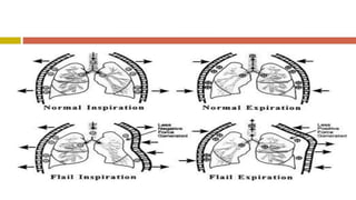 9 -CHEST INJURY.pdf