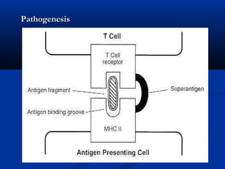 PathogenesisPathogenesis
 