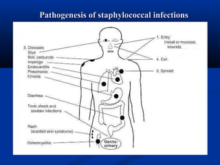 Pathogenesis of staphylococcal infectionsPathogenesis of staphylococcal infections
 