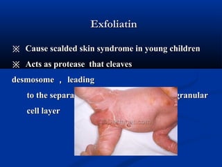 ExfoliatinExfoliatin
※※ Cause scalded skin syndrome in young childrenCause scalded skin syndrome in young children
※※ Acts as protease that cleavesActs as protease that cleaves
desmosomedesmosome ，， leadingleading
to the separation of the epidermis at the granularto the separation of the epidermis at the granular
cell layercell layer
 