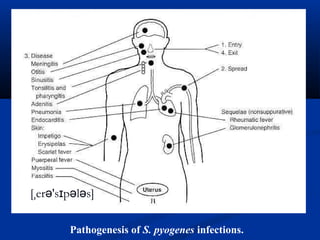 Pathogenesis of S. pyogenes infections.
[ er 's p l s]ˌ ə ɪ ə ə
 