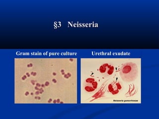 Gram stain of pure culture Urethral exudate
§3 Neisseria§3 Neisseria
 