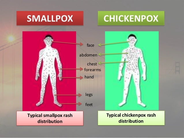 9 comparative diagnosis