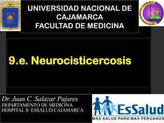UNIVERSIDAD NACIONAL DE
CAJAMARCA
FACULTAD DE MEDICINA
Dr. Juan C. Salazar Pajares
DEPARTAMENTO DE MEDICINA
HOSPITAL II ESSALUD CAJAMARCA
9.e. Neurocisticercosis
 