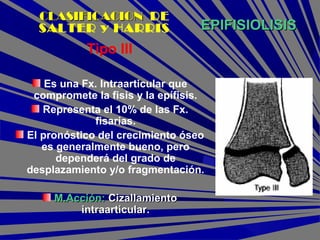 EPIFISIOLISISEPIFISIOLISIS
Tipo III
Es una Fx. Intraarticular que
compromete la fisis y la epífisis.
Representa el 10% de las Fx.
fisarias.
El pronóstico del crecimiento óseo
es generalmente bueno, pero
dependerá del grado de
desplazamiento y/o fragmentación.
M.Acción:M.Acción: CizallamientoCizallamiento
intraarticular.intraarticular.
CLASIFICACIONCLASIFICACION DE
SALTER y HARRIS
 