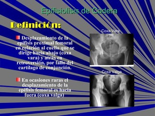 Definición:Definición:
Desplazamiento de la
epífisis proximal femoral
en relación al cuello que se
dirige hacia abajo (coxa
vara) y atrás en
retroversión, por fallo del
cartílago de conjunción.
En ocasiones raras el
desplazamiento de la
epífisis femoral es hacia
fuera (coxa valga)
Epifisiolisis de CaderaEpifisiolisis de Cadera
Coxa Vara
Coxa Valga
 