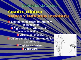 Limitación de rotación interna y
de abducción.
Signo de Howorth (rotación
externa a la flexión pasiva).
Atrofia del muslo.
Discrepancia en la longitud de la
extremidad.
Rigidez en flexión.
Coxa vara.
Epifisiolisis de CaderaEpifisiolisis de Cadera
Cuadro clínico:Cuadro clínico:
Signos y síntomas (estable):Signos y síntomas (estable):
 