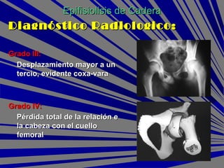 Grado III:Grado III:
Desplazamiento mayor a unDesplazamiento mayor a un
tercio, evidente coxa-varatercio, evidente coxa-vara
Grado IV:Grado IV:
Pérdida total de la relación ePérdida total de la relación e
la cabeza con el cuellola cabeza con el cuello
femoralfemoral
Epifisiolisis de CaderaEpifisiolisis de Cadera
Diagnóstico Radiologico:Diagnóstico Radiologico:
 