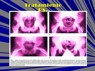 TratamientoTratamiento
Qx.Qx.
 