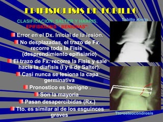 Error en el Dx. Inicial de la lesión.Error en el Dx. Inicial de la lesión.
No desplazadas, el trazo de Fx.
recorre toda la Fisis
(desprendimiento epifisiario)
El trazo de Fx. recorre la Fisis y sale
hacia la diafisis (I y II de Salter).
Casi nunca se lesiona la capa
germinativa
Pronostico es benigno .
Son la mayoria
Pasan desapercibidas (Rx.)
Tto. es similar al de los esguinces
graves
EPIFISIOLISIS DE TOBILLOEPIFISIOLISIS DE TOBILLO
CLASIFICACIÓN: SALTER Y HARRIS.
EPIFISIOLISIS " BENIGNAS":
Tto•osteocondrosis
Tobillo afecto
 