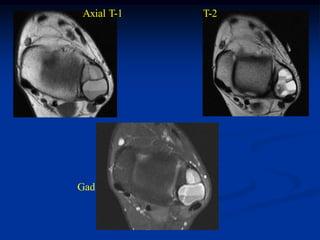 Axial T-1   T-2




Gad
 