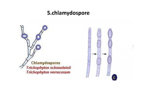5.chlamydospore
 