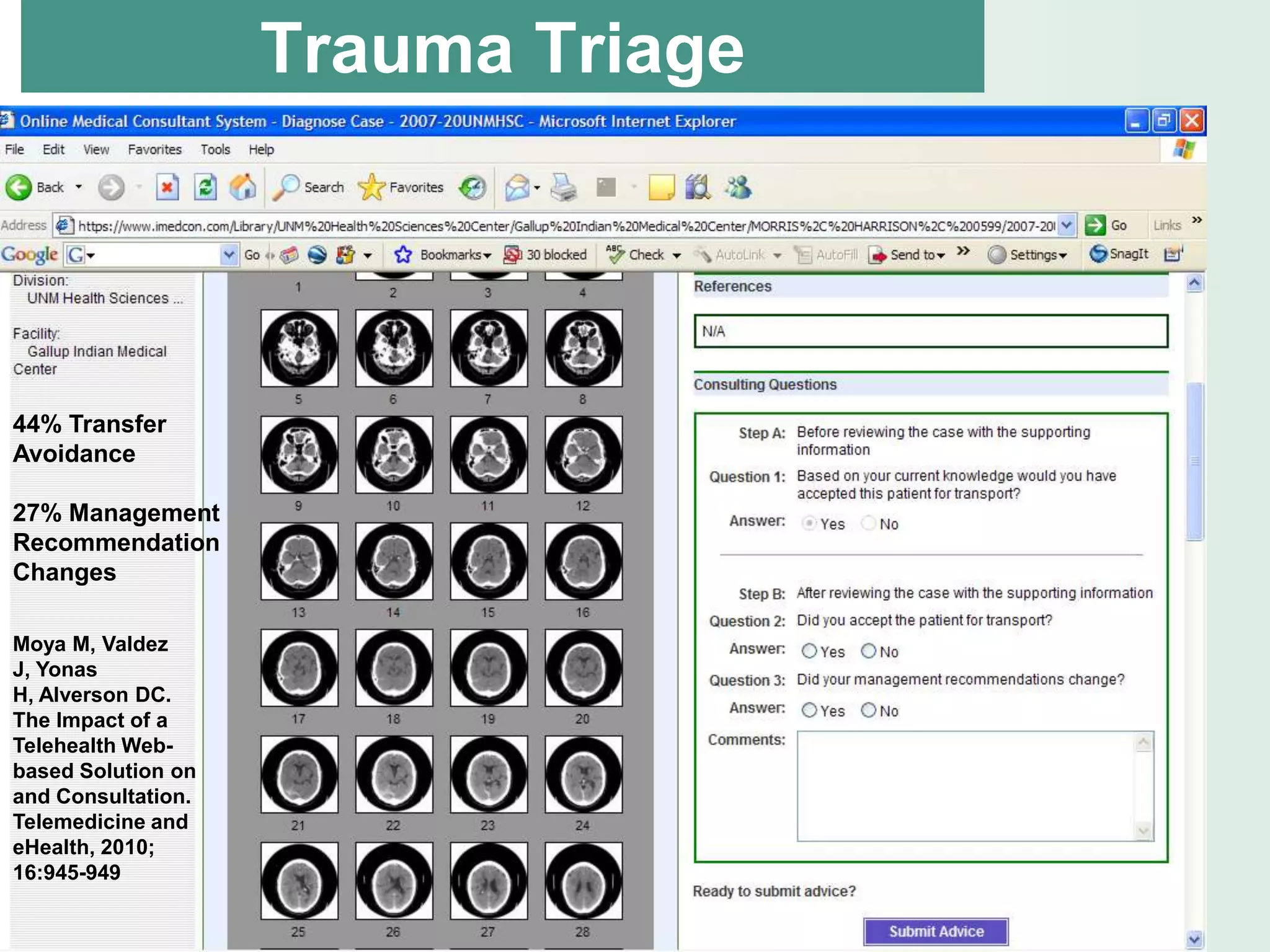 Trauma Triage




44% Transfer
Avoidance

27% Management
Recommendation
Changes

Moya M, Valdez
J, Yonas
H, Alverson DC.
The Impact of a
Telehealth Web-
based Solution on
and Consultation.
Telemedicine and
eHealth, 2010;
16:945-949
 