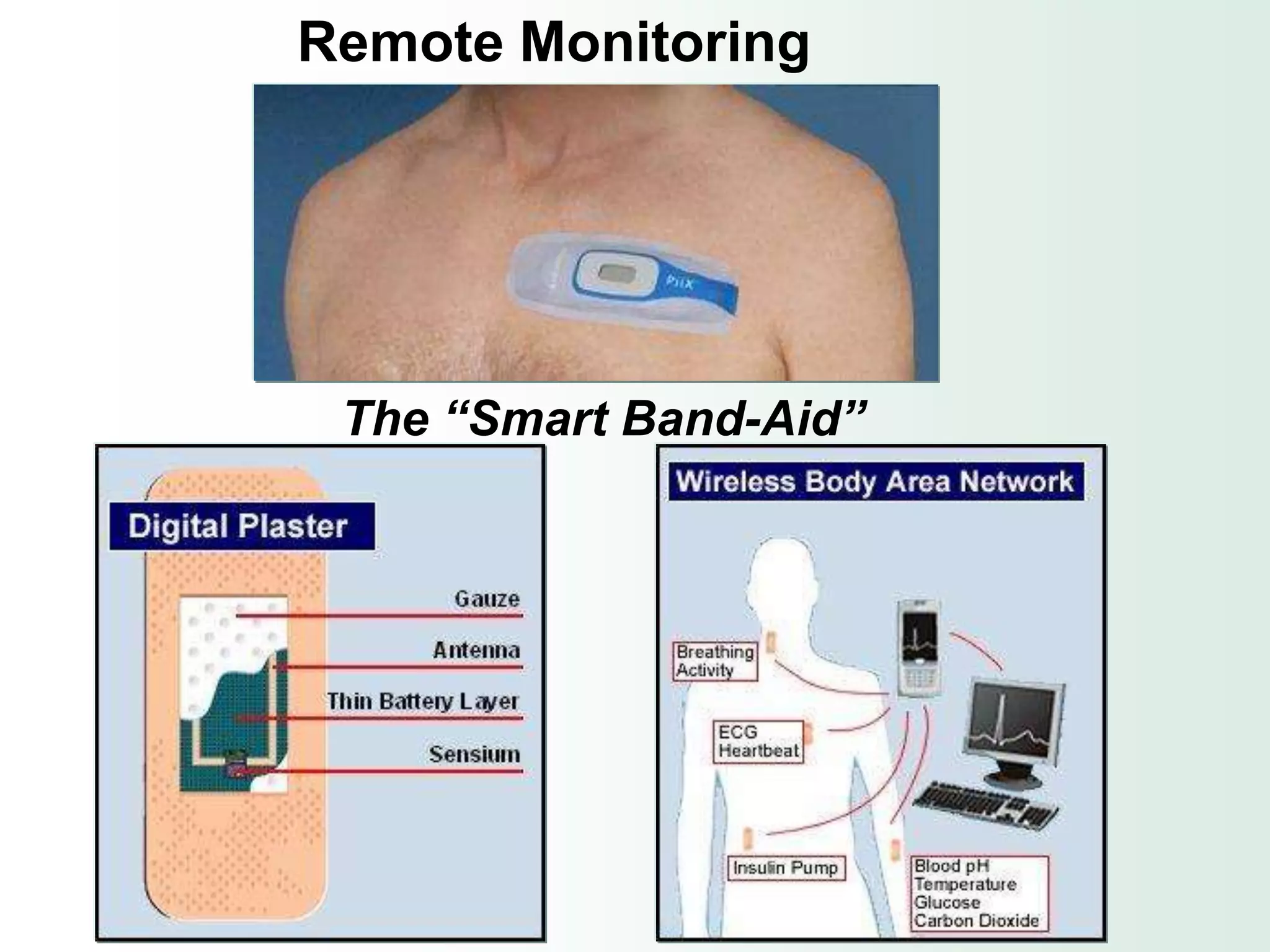 Remote Monitoring




 The “Smart Band-Aid”
 